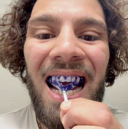 Bandes Blanchissantes Kimby™ (sans peroxyde)